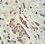 ABCC11 / MRP8 Antibody (aa343-372)