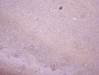 Polyclonal Rabbit anti-Human PRKCG / PKC-Gamma Antibody (IHC, WB)