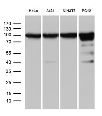 KPNB1 / Importin Beta Antibody (aa1-200, clone OTI6H3)