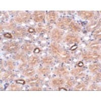 NOTUM Antibody