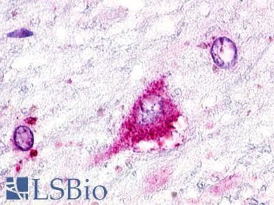 PathPlus™ Polyclonal Rabbit anti-Human GPR22 Antibody (Cytoplasmic Domain, IHC)