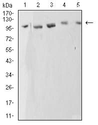 ATP2A1 / SERCA1 Antibody (clone 4F11F6)