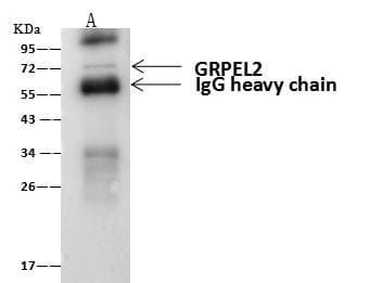 B3GNT3 / TMEM3 Antibody (Preservative Free)