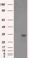 AKR1A1 Antibody (clone OTI4G6)