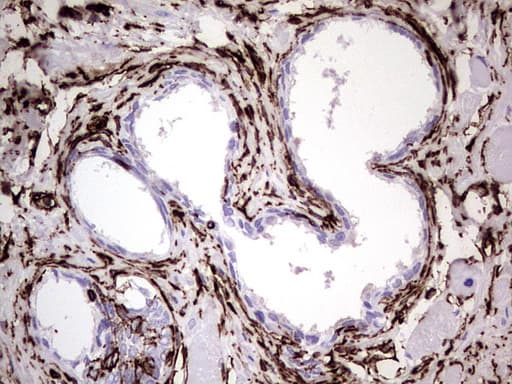 Vimentin Antibody (clone UMAB160, Carrier-free)