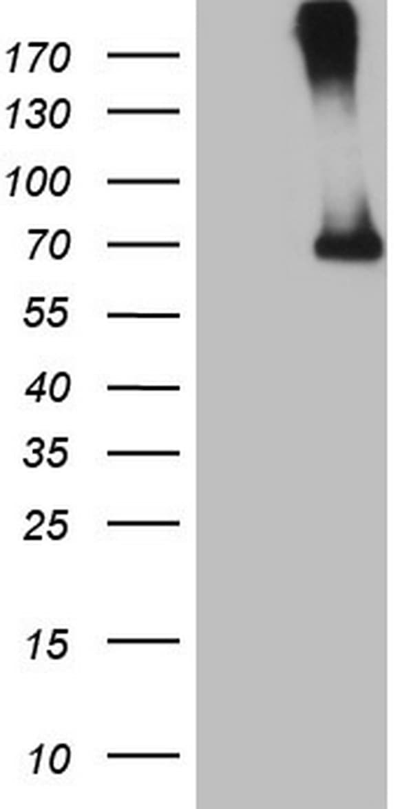 CFI / Complement Factor I Antibody (aa340-583, clone OTI4G8)