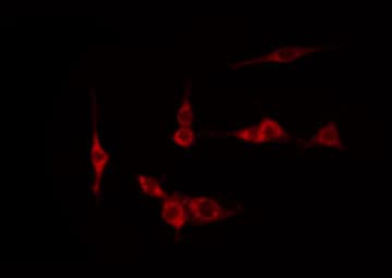 Polyclonal Rabbit anti-Human NFKBIE / IKB Epsilon Antibody (phospho-Ser22, IHC, IF, WB)