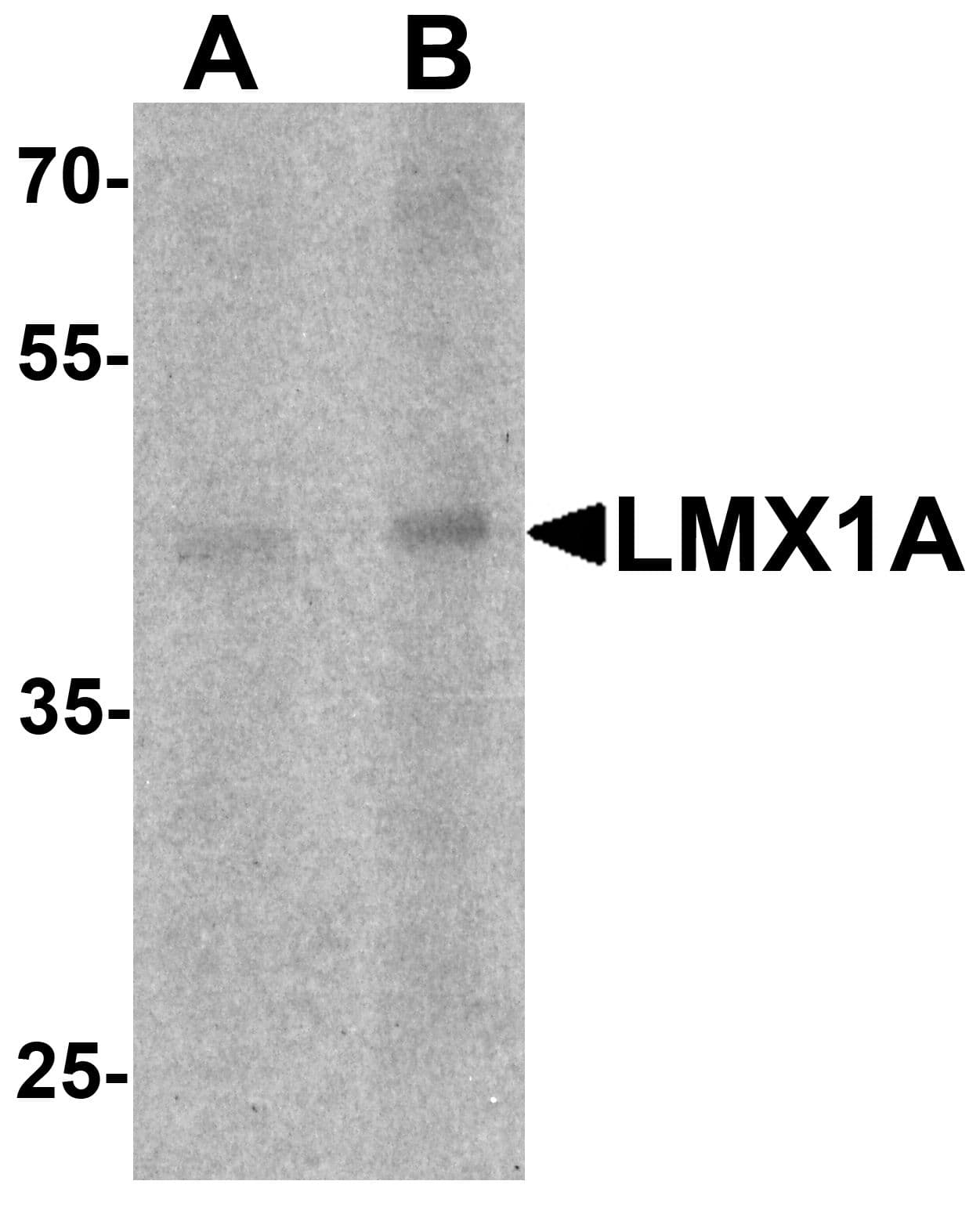 IHC-plus™ LMX1A Antibody