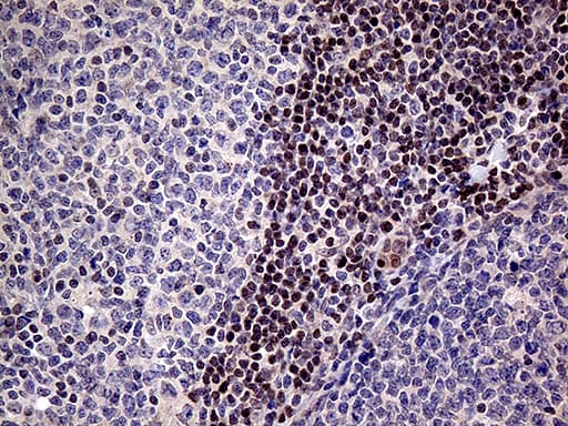 Monoclonal Mouse anti-Human FOSL2 / FRA-2 Antibody (clone OTI2B4, aa110-326, IHC, WB)