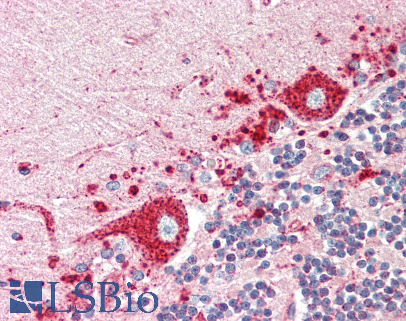 IHC-plus™ LAMP1 / CD107a Antibody (clone 6E2)