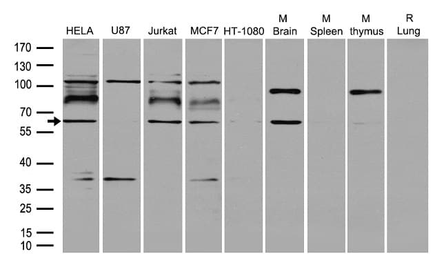 Polyclonal Rabbit anti-Human RNF168 Antibody (WB)