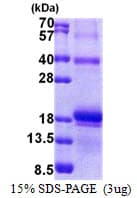 Human IL17F Protein (Recombinant His)