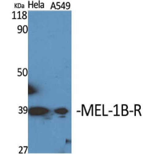 MTNR1B / MT2 Antibody (270-350 aa, C-terminal)