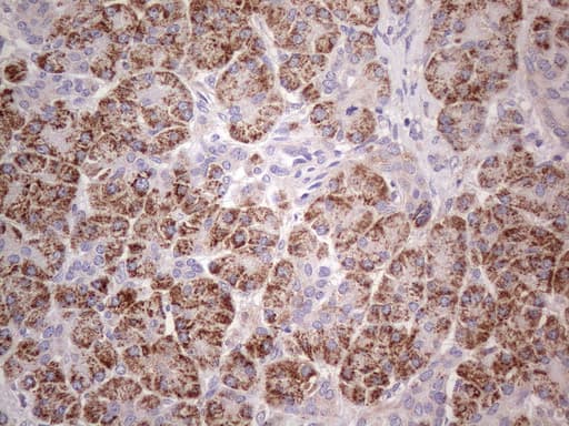 ABAT Antibody (aa29-323, clone UMAB179, Carrier-free)