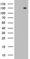 Monoclonal Mouse anti-Human PR / Progesterone Receptor Antibody (clone OTI15C1, aa1-298, WB)