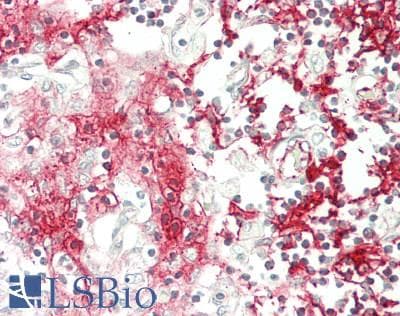 IHC-plus™ Monoclonal Mouse anti-Human MHC Class II Antibody (clone TDR31.1, Azide-free, IHC, WB)
