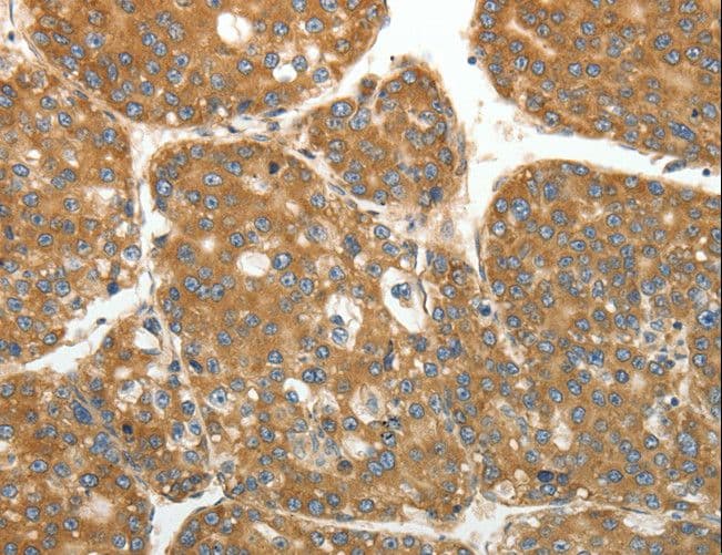 Polyclonal Rabbit anti-Human RPLP0 Antibody (IHC, WB)