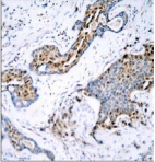 ER Alpha / Estrogen Receptor Antibody