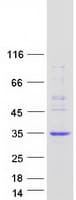 Human ECSIT Protein (Recombinant Myc-DDK (Flag))