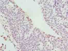 Polyclonal Rabbit anti-Human C17orf62 Antibody (IHC, WB)
