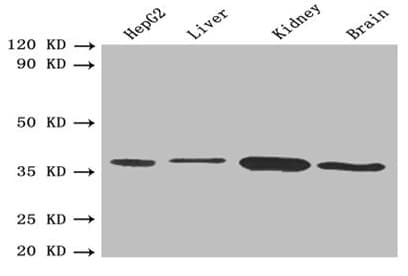 IHC-plus™ SDR9C1 / BDH1 Antibody (aa47-343)