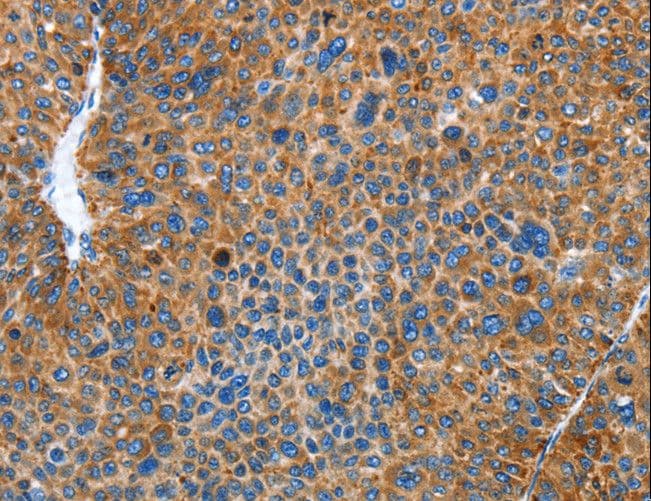 AUP1 Antibody
