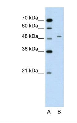 GPT / Alanine Transaminase Antibody (aa81-130, HRP)