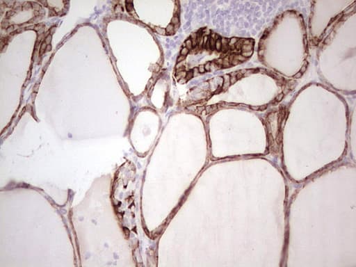 ABCB1 / MDR1 / P Glycoprotein Antibody (aa995-1280, clone OTI8A9)