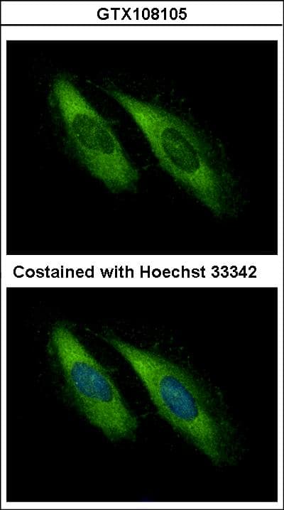 UNC13D Antibody (aa1029-1090)