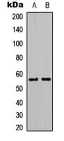 Polyclonal Rabbit anti-Human KCNJ3 / GIRK1 Antibody (Internal, IF, WB)