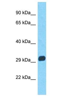 MAGEA9 Antibody (aa8-57)