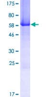 Human CHORDC1 / CHP1 Protein (Recombinant GST)