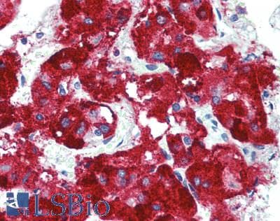 IHC-plus™ Polyclonal Rabbit anti-Human TNFRSF6B / DCR3 Antibody (IHC, WB)