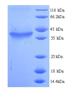 Mouse HAS2 Protein (Recombinant His)