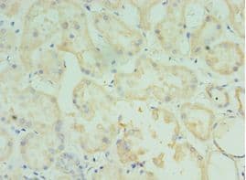 TMOD3 / Tropomodulin 3 Antibody (aa1-352)