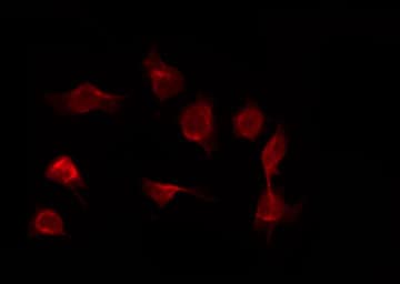 PLCG1 Antibody (phospho-Tyr783)