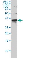 IHC-plus™ ARH / LDLRAP1 Antibody (clone 4G4-D5)