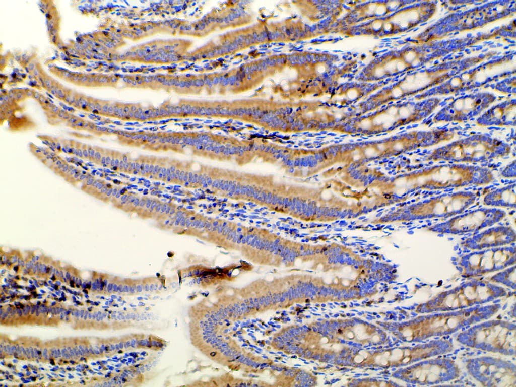 PIK3R1 / p85 Alpha Antibody (phospho-Tyr607)
