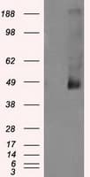 LOX / Lysyl Oxidase Antibody (clone OTI3C3)