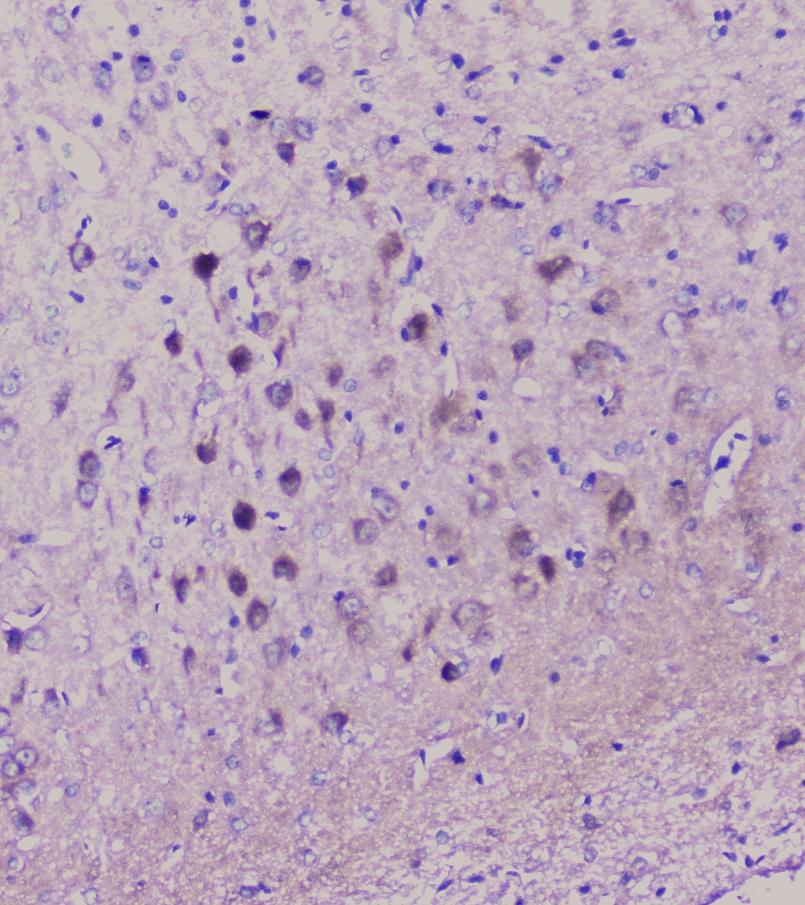 ENO2 / NSE Antibody