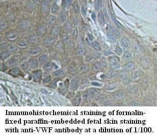 VWF / Von Willebrand Factor Antibody (aa83-199)