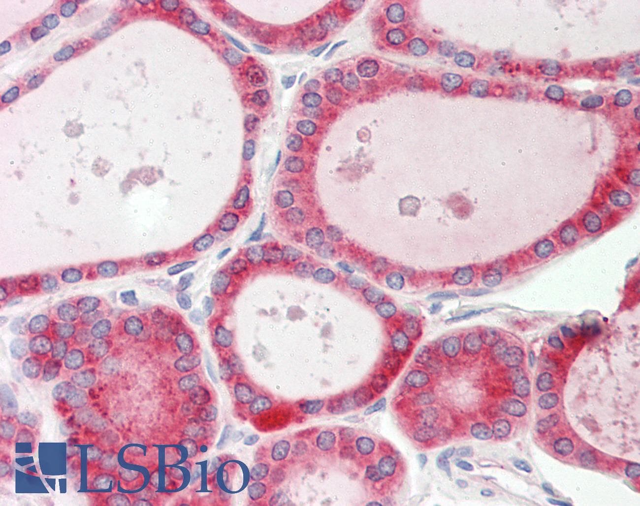 PathPlus™ Polyclonal Rabbit anti-Human CALR / Calreticulin Antibody (aa52-101, IHC, WB)