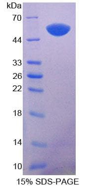 Mouse KRT14 / CK14 / Cytokeratin 14 Protein (Recombinant His-T7)