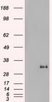 NOG / Noggin Antibody (clone OTI1H8)