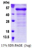 Human FGFR1OP / FOP Protein (Recombinant His)