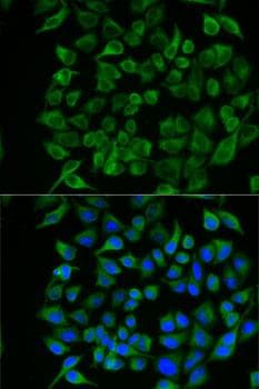PAEP / Glycodelin / GdF Antibody