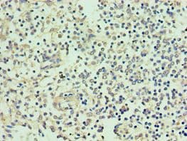 Polyclonal Rabbit anti-Human SMYD1 Antibody (aa1-350, IHC, WB)