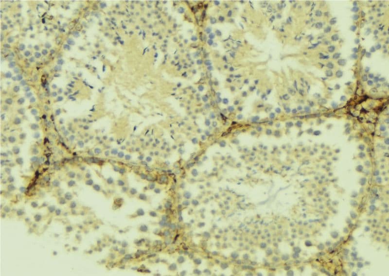 ATG4D Antibody