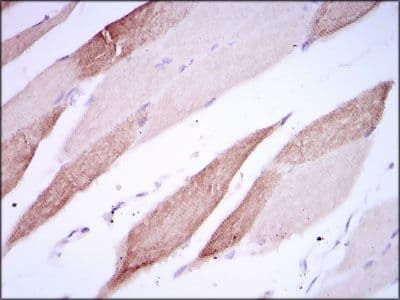 Monoclonal Mouse anti-Human ALCAM / CD166 Antibody (clone 5B3, Amino Acid: 405-524, IHC, WB)
