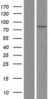 FES Protein (Over-Expression Lysate Myc-DDK (Flag))